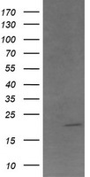 ANAPC11 / APC11 Antibody - HEK293T cells were transfected with the pCMV6-ENTRY control (Left lane) or pCMV6-ENTRY ANAPC11 (Right lane) cDNA for 48 hrs and lysed. Equivalent amounts of cell lysates (5 ug per lane) were separated by SDS-PAGE and immunoblotted with anti-ANAPC11.