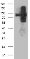 ANAPC2 / APC2 Antibody - HEK293T cells were transfected with the pCMV6-ENTRY control (Left lane) or pCMV6-ENTRY ANAPC2 (Right lane) cDNA for 48 hrs and lysed. Equivalent amounts of cell lysates (5 ug per lane) were separated by SDS-PAGE and immunoblotted with anti-ANAPC2.