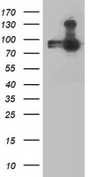 ANAPC2 / APC2 Antibody - HEK293T cells were transfected with the pCMV6-ENTRY control (Left lane) or pCMV6-ENTRY ANAPC2 (Right lane) cDNA for 48 hrs and lysed. Equivalent amounts of cell lysates (5 ug per lane) were separated by SDS-PAGE and immunoblotted with anti-ANAPC2.