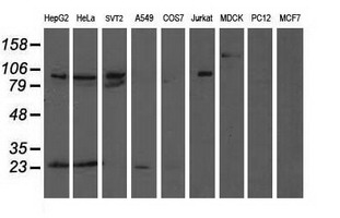 ANAPC2 / APC2 Antibody - Western blot of extracts (35 ug) from 9 different cell lines by using anti-ANAPC2 monoclonal antibody (HepG2: human; HeLa: human; SVT2: mouse; A549: human; COS7: monkey; Jurkat: human; MDCK: canine; PC12: rat; MCF7: human).