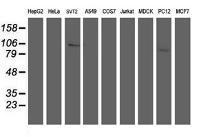 ANAPC2 / APC2 Antibody - Western blot of extracts (35 ug) from 9 different cell lines by using anti-ANAPC2 monoclonal antibody.