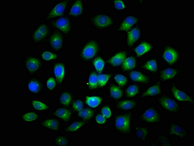 ANAPC2 / APC2 Antibody - Immunofluorescence staining of A549 cells with ANAPC2 Antibody at 1:116, counter-stained with DAPI. The cells were fixed in 4% formaldehyde, permeabilized using 0.2% Triton X-100 and blocked in 10% normal Goat Serum. The cells were then incubated with the antibody overnight at 4°C. The secondary antibody was Alexa Fluor 488-congugated AffiniPure Goat Anti-Rabbit IgG(H+L).