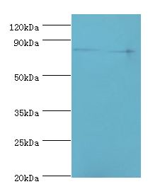 ANAPC5 / APC5 Antibody - Western blot. All lanes: ANAPC5 antibody at 2 ug/ml. Lane 1: 293T whole cell lysate. Lane 2: NIH3T3 whole cell lysate. Secondary antibody: Goat polyclonal to rabbit at 1:10000 dilution. Predicted band size: 85 kDa. Observed band size: 85 kDa Immunohistochemistry.