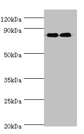 ANAPC5 / APC5 Antibody - Western blot All lanes: ANAPC5 antibody at 2µg/ml Lane 1: 293T whole cell lysate Lane 2: NIH/3T3 whole cell lysate Secondary Goat polyclonal to rabbit IgG at 1/10000 dilution Predicted band size: 86, 26, 73 kDa Observed band size: 86 kDa