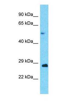 ANAPC5 / APC5 Antibody - Western blot of ANAPC5 Antibody with Ovary Tumor lysate.  This image was taken for the unconjugated form of this product. Other forms have not been tested.