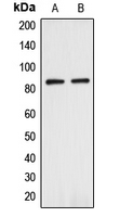 ANAPC5 / APC5 Antibody - Western blot analysis of ANAPC expression in HEK293T (A); HeLa (B) whole cell lysates.
