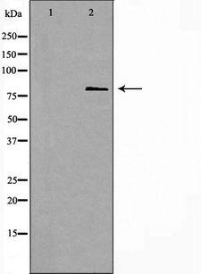 ANAPC5 / APC5 Antibody - Western blot analysis of extracts of HeLa cells using ANAPC5 antibody. The lane on the left is treated with the antigen-specific peptide.