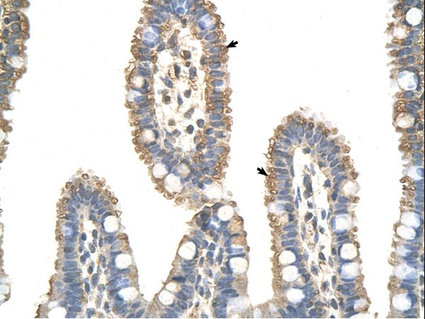 ANAPC7 / APC7 Antibody - ANAPC7 / APC7 antibody ARP41605_P050-NP_057322-ANAPC7(anaphase promoting complex subunit 7) Antibody was used in IHC to stain formalin-fixed, paraffin-embedded human intestine.  This image was taken for the unconjugated form of this product. Other forms have not been tested.