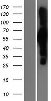 ANAPC7 / APC7 Protein - Western validation with an anti-DDK antibody * L: Control HEK293 lysate R: Over-expression lysate