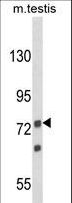 ANGEL1 Antibody - Western blot of ANGEL1 Antibody in mouse testis tissue lysates (35 ug/lane). ANGEL1 (arrow) was detected using the purified antibody.