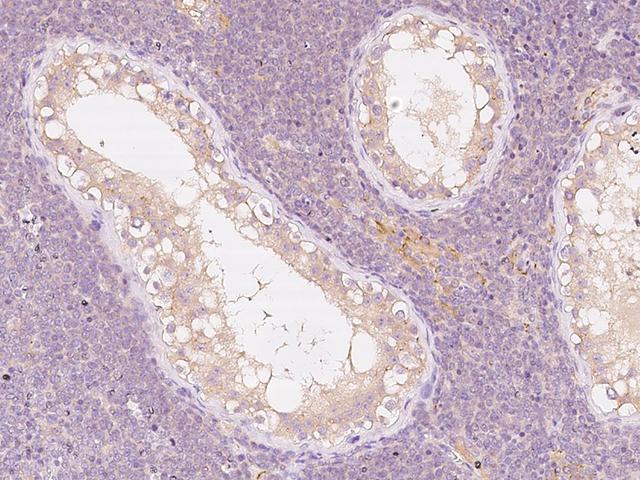 ANGEL1 Antibody - Immunochemical staining Angel1 in human testis with rabbit polyclonal antibody at 1:300 dilution, formalin-fixed paraffin embedded sections.