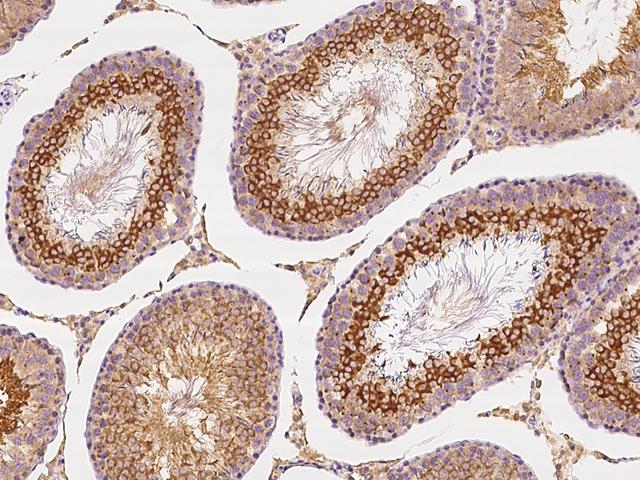 ANGEL1 Antibody - Immunochemical staining Angel1 in rat testis with rabbit polyclonal antibody at 1:300 dilution, formalin-fixed paraffin embedded sections.