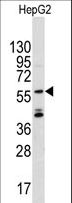 ANGEL2 Antibody - Western blot of anti-ANGEL2 antibody in CEM cell line lysates (35 ug/lane). ANGEL2 (arrow) was detected using the purified antibody.