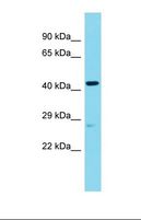 ANGEL2 Antibody - Western blot of Human Placenta. ANGEL2 antibody dilution 1.0 ug/ml.  This image was taken for the unconjugated form of this product. Other forms have not been tested.