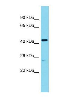 ANGEL2 Antibody - Western blot of Human Placenta. ANGEL2 antibody dilution 1.0 ug/ml.  This image was taken for the unconjugated form of this product. Other forms have not been tested.