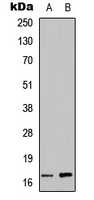 Angiogenin / ANG Antibody - Western blot analysis of ANG expression in HEK293T (A); NS-1 (B) whole cell lysates.