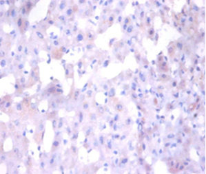 Angiogenin / ANG Antibody - Immunohistochemistry of paraffin-embedded human liver tissue using ANG Antibody at dilution of 1:100