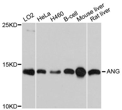 Angiogenin / ANG Antibody - Western blot analysis of extracts of various cell lines, using ANG antibody at 1:1000 dilution. The secondary antibody used was an HRP Goat Anti-Rabbit IgG (H+L) at 1:10000 dilution. Lysates were loaded 25ug per lane and 3% nonfat dry milk in TBST was used for blocking. An ECL Kit was used for detection and the exposure time was 90s.