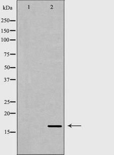 Angiogenin / ANG Antibody - Western blot analysis of extracts of mouse liver tissue using ANG antibody. The lane on the left is treated with the antigen-specific peptide.