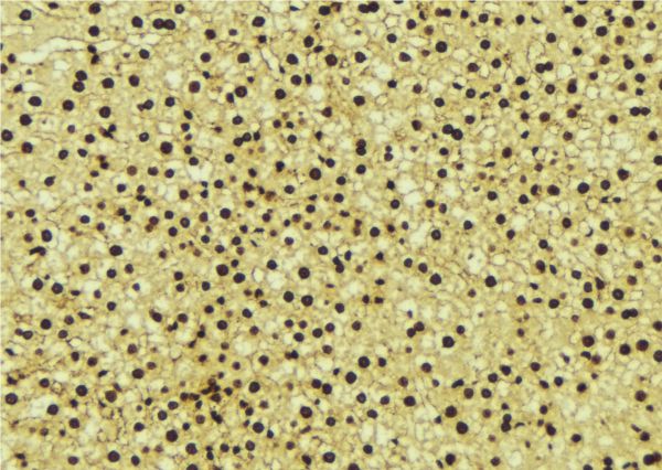 Angiogenin / ANG Antibody - 1:100 staining mouse liver tissue by IHC-P. The sample was formaldehyde fixed and a heat mediated antigen retrieval step in citrate buffer was performed. The sample was then blocked and incubated with the antibody for 1.5 hours at 22°C. An HRP conjugated goat anti-rabbit antibody was used as the secondary.