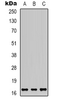 Angiogenin / ANG Antibody - Western blot analysis of ANG expression in HEK293T (A); HeLa (B); U87MG (C) whole cell lysates.