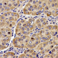 Angiogenin / ANG Antibody - Immunohistochemical analysis of ANG staining in human liver formalin fixed paraffin embedded tissue section. The section was pre-treated using heat mediated antigen retrieval with sodium citrate buffer (pH 6.0). The section was then incubated with the antibody at room temperature and detected using an HRP polymer system. DAB was used as the chromogen. The section was then counterstained with hematoxylin and mounted with DPX.