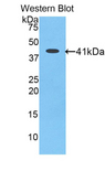 Angiotensin III Antibody - Western blot of recombinant Angiotensin III.  This image was taken for the unconjugated form of this product. Other forms have not been tested.