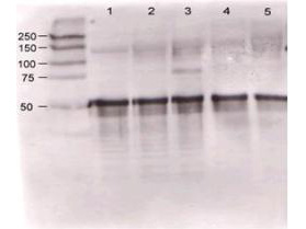 ANGPT1 / Angiopoietin-1 Antibody - Rabbit anti-ANG1 was used at a 1:500 dilution to detect mouse Ang-1 by western blot against supernatants of mouse angiopoietin-expressing endothelial cells. Lane 1 - wt endothelial cells. Lane 2 - mouse Ang-1 (clone 1-8) expressing cells. Lane 3 - mouse Ang-1 (clone 1-15) expressing cells. Lane 4 - mouse Ang-2 (clone 2-9) expressing cells. Approximately 20 µg of each lysate was used for 10% SDS-PAGE. Immunoprecipitation preceded the reaction with primary antibody at room temperature for 1 h. After subsequent washing, a 1:5,000 dilution of HRP conjugated Gt-a-Rabbit IgG preceded color development.