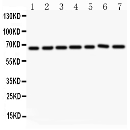 ANGPT1 / Angiopoietin-1 Antibody - Anti-Angiopoietin 1 Picoband antibody, All lanes: Anti Angiopoietin1 at 0.5ug/ml Lane 1: HELA Whole Cell Lysate at 40ugLane 2: MCF-7 Whole Cell Lysate at 40ugLane 3: COLO320 Whole Cell Lysate at 40ugLane 4: A549 Whole Cell Lysate at 40ug Lane 5: HEPG2 Whole Cell Lysate at 40ug Lane 6: 293T Whole Cell Lysate at 40ug Lane 7: SW620 Whole Cell Lysate at 40ug Predicted bind size: 57KD Observed bind size: 65KD