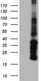 ANGPT1 / Angiopoietin-1 Antibody - Human recombinant protein fragment corresponding to amino acids 198-498 of human ANGPT1 (NP_001137) produced in E.coli.