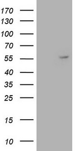 ANGPT1 / Angiopoietin-1 Antibody - HEK293T cells were transfected with the pCMV6-ENTRY control. (Left lane) or pCMV6-ENTRY ANGPT1. (Right lane) cDNA for 48 hrs and lysed. Equivalent amounts of cell lysates. (5 ug per lane) were separated by SDS-PAGE and immunoblotted with anti-ANGPT1. (1:500)