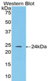 ANGPT1 / Angiopoietin-1 Antibody - Western blot of recombinant ANGPT1 / ANG1 / Angiopoietin-1.  This image was taken for the unconjugated form of this product. Other forms have not been tested.
