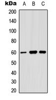 ANGPT1 / Angiopoietin-1 Antibody - Western blot analysis of Angiopoietin-1 expression in MCF7 (A); HeLa (B); U87MG (C) whole cell lysates.