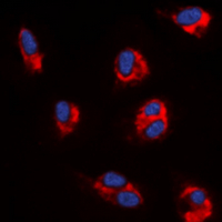 ANGPT1 / Angiopoietin-1 Antibody - Immunofluorescent analysis of Angiopoietin-1 staining in MCF7 cells. Formalin-fixed cells were permeabilized with 0.1% Triton X-100 in TBS for 5-10 minutes and blocked with 3% BSA-PBS for 30 minutes at room temperature. Cells were probed with the primary antibody in 3% BSA-PBS and incubated overnight at 4 deg C in a humidified chamber. Cells were washed with PBST and incubated with a DyLight 594-conjugated secondary antibody (red) in PBS at room temperature in the dark. DAPI was used to stain the cell nuclei (blue).