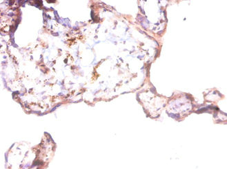 ANGPT1 / Angiopoietin-1 Antibody - Immunohistochemistry of paraffin-embedded human placenta tissue using ANGPT1 Antibody at dilution of 1:50