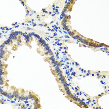 ANGPT1 / Angiopoietin-1 Antibody - Immunohistochemistry of paraffin-embedded rat lung tissue.
