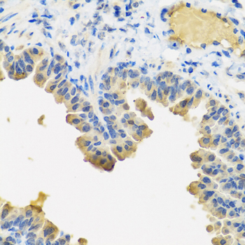 ANGPT1 / Angiopoietin-1 Antibody - Immunohistochemistry of paraffin-embedded mouse lung tissue.