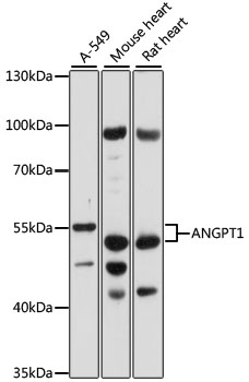 ANGPT1 / Angiopoietin-1 Antibody - Western blot analysis of extracts of various cell lines, using ANGPT1 antibody at 1:1000 dilution. The secondary antibody used was an HRP Goat Anti-Rabbit IgG (H+L) at 1:10000 dilution. Lysates were loaded 25ug per lane and 3% nonfat dry milk in TBST was used for blocking. An ECL Kit was used for detection and the exposure time was 30s.