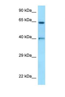 ANGPT1 / Angiopoietin-1 Antibody - ANGPT1 / Angiopoietin-1 antibody Western blot of ACHN Cell lysate. Antibody concentration 1 ug/ml.  This image was taken for the unconjugated form of this product. Other forms have not been tested.