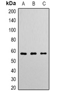 ANGPT1 / Angiopoietin-1 Antibody - Western blot analysis of Angiopoietin-1 expression in K562 (A); HeLa (B); Jurkat (C) whole cell lysates.
