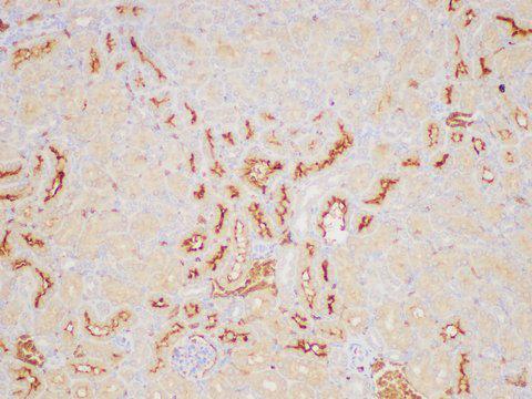 ANGPT2 / Angiopoietin-2 Antibody - Immunohistochemistry of paraffin-embedded Mouse kidney using ANGPT2 Polycloanl Antibody at dilution of 1:200.