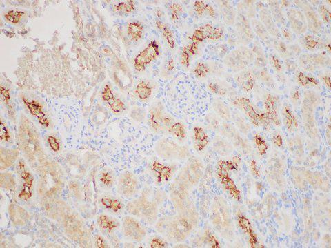 ANGPT2 / Angiopoietin-2 Antibody - Immunohistochemistry of paraffin-embedded Rat kidney using ANGPT2 Polycloanl Antibody at dilution of 1:200.