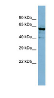 ANGPT4 / Angiopoietin-4 Antibody - ANGPT4 / Angiopoietin-4 antibody Western blot of Jurkat lysate. This image was taken for the unconjugated form of this product. Other forms have not been tested.