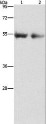 ANGPT4 / Angiopoietin-4 Antibody - Western blot analysis of Human right lung and left lung cancer tissue, using ANGPT4 Polyclonal Antibody at dilution of 1:480.