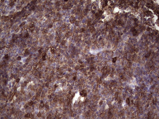 ANGPTL1 Antibody - Immunohistochemical staining of paraffin-embedded Human tonsil within the normal limits using anti-ANGPTL1 mouse monoclonal antibody. (Heat-induced epitope retrieval by 1 mM EDTA in 10mM Tris, pH8.5, 120C for 3min,