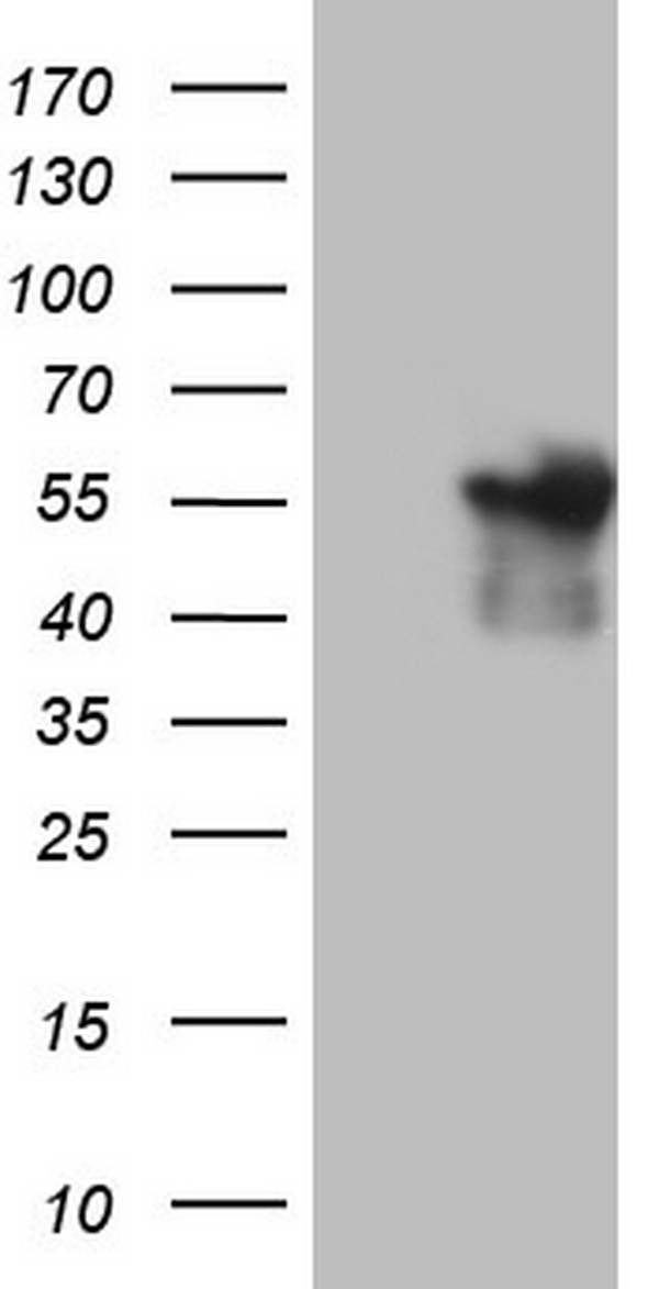 ANGPTL1 Antibody - HEK293T cells were transfected with the pCMV6-ENTRY control (Left lane) or pCMV6-ENTRY ANGPTL1 (Right lane) cDNA for 48 hrs and lysed. Equivalent amounts of cell lysates (5 ug per lane) were separated by SDS-PAGE and immunoblotted with anti-ANGPTL1.