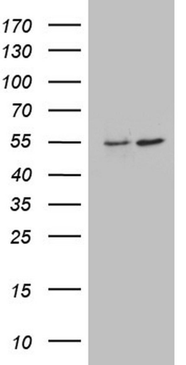 ANGPTL1 Antibody - HEK293T cells were transfected with the pCMV6-ENTRY control (Left lane) or pCMV6-ENTRY ANGPTL1 (Right lane) cDNA for 48 hrs and lysed. Equivalent amounts of cell lysates (5 ug per lane) were separated by SDS-PAGE and immunoblotted with anti-ANGPTL1.
