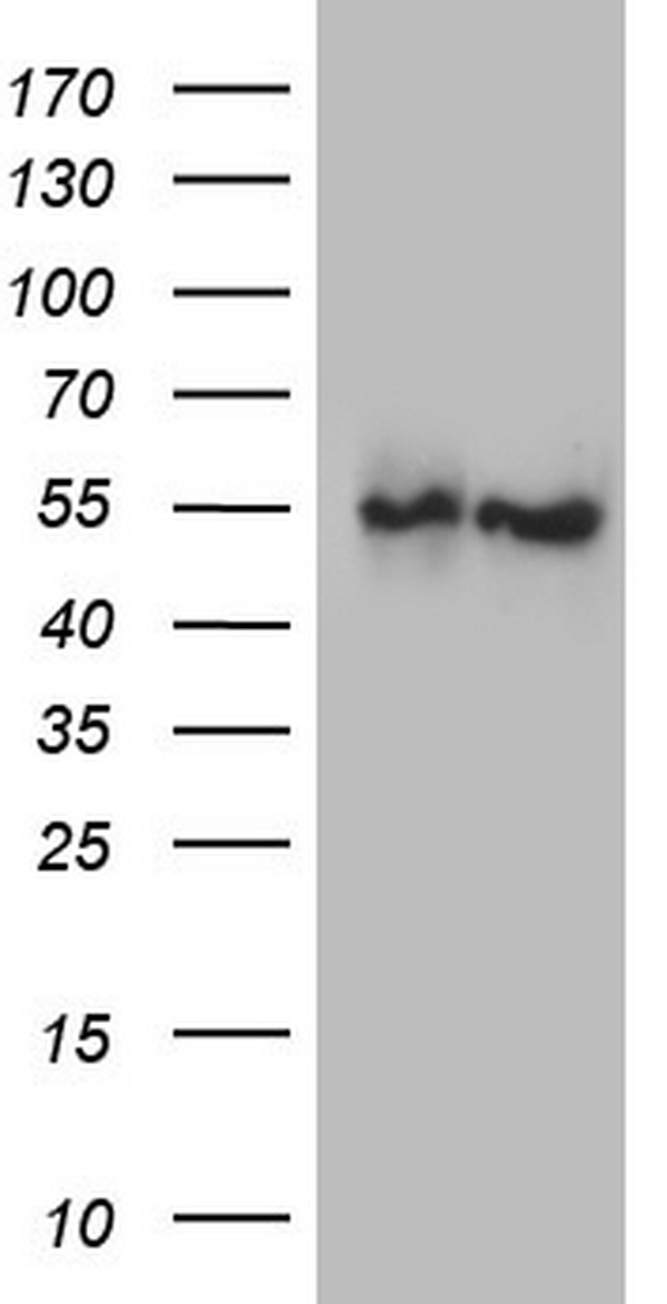 ANGPTL1 Antibody - HEK293T cells were transfected with the pCMV6-ENTRY control. (Left lane) or pCMV6-ENTRY ANGPTL1. (Right lane) cDNA for 48 hrs and lysed. Equivalent amounts of cell lysates. (5 ug per lane) were separated by SDS-PAGE and immunoblotted with anti-ANGPTL1.
