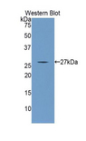 ANGPTL1 Antibody - Western blot of recombinant ANGPTL1.  This image was taken for the unconjugated form of this product. Other forms have not been tested.
