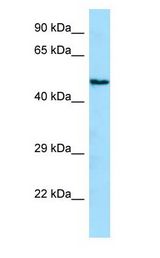 ANGPTL1 Antibody - ANGPTL1 antibody Western Blot of Jurkat.  This image was taken for the unconjugated form of this product. Other forms have not been tested.